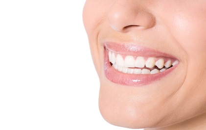 Отбеливание зубов Opalescense