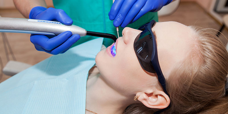 Косметическая реставрация зубов в стоматологии