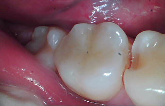 Работа врача: Комплексное лечение зубов